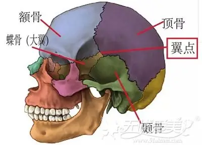面部颧骨颧弓宽究竟选填充太阳穴还是颧骨内推