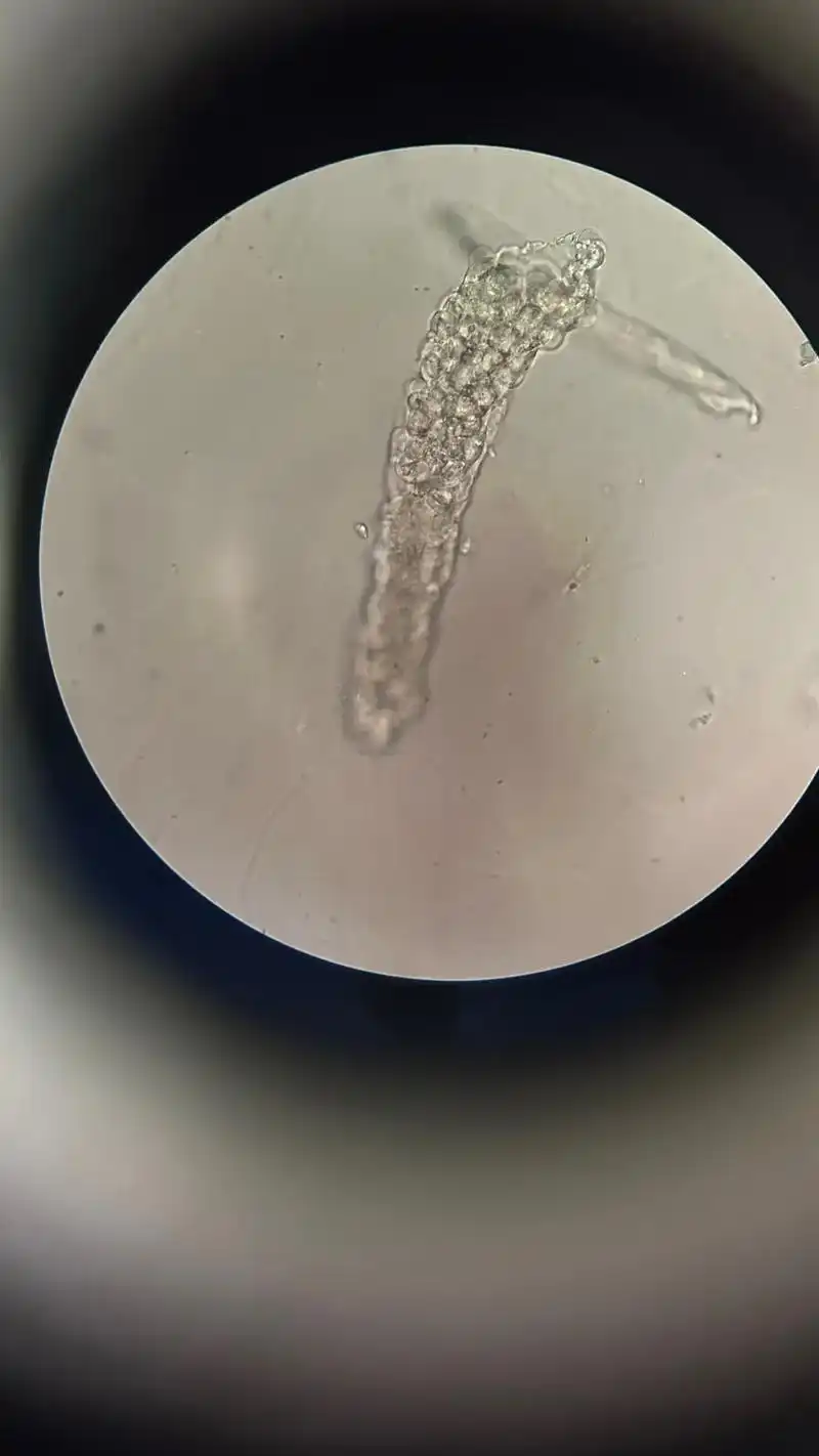 尿沉渣镜检#显微镜下的世界 #微观世界 #细胞 - 抖音