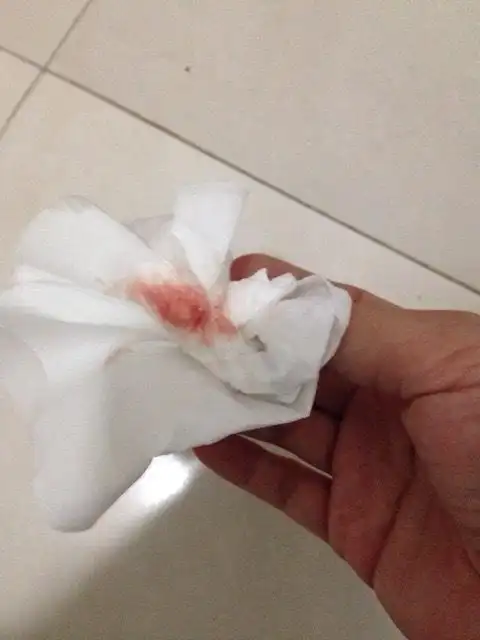 推荐回答 根据你所说的是先兆流产情况,可服用黄体酮和维生素e,进行