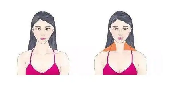 打完瘦肩针有什么影响吗?