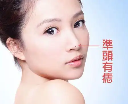 女人鼻头长痣好不好女人鼻头长痣代表什么