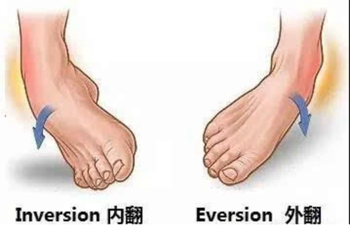 单纯内翻扭伤时,容损伤外侧的跟腓韧带;外翻扭伤,由于三角韧带比较