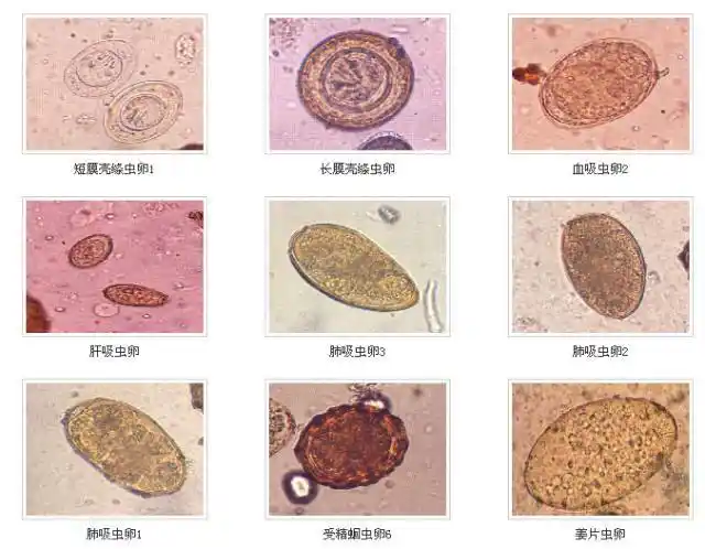 部分图片转载自"好兽医学堂"常见人体寄生虫蠕虫卵及幼虫形态鉴别