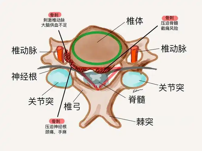 骨头上长"刺"了,到底要不要紧?