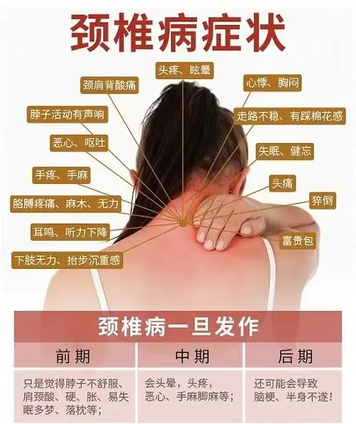 颈椎病症状你都知道有哪些吗