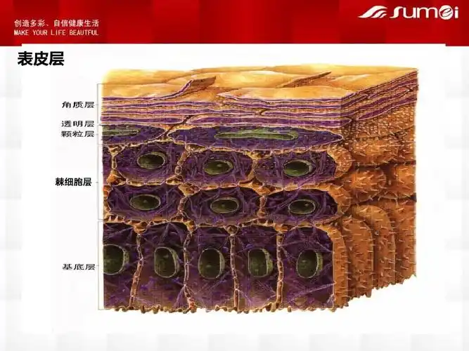 表皮层 棘细胞层