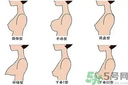 女性乳房下垂的原因是什么?女性乳房下垂的分类有哪些?