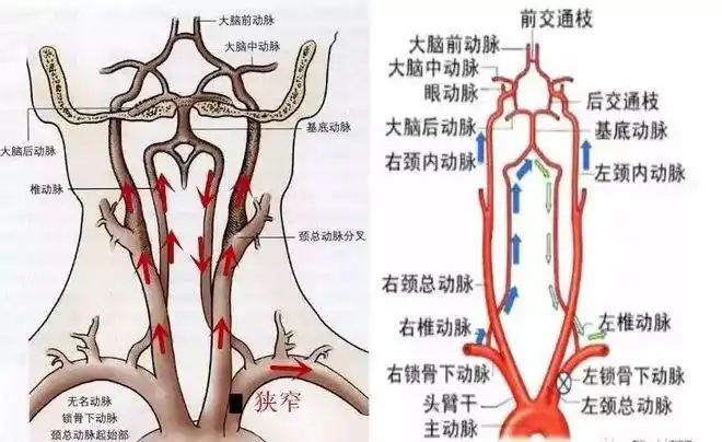 正常情况下,左锁骨下动脉一边将血液向上输送给左侧椎动脉,一边给左臂