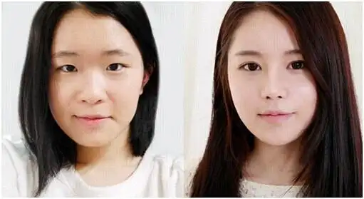 单眼皮vs双眼皮