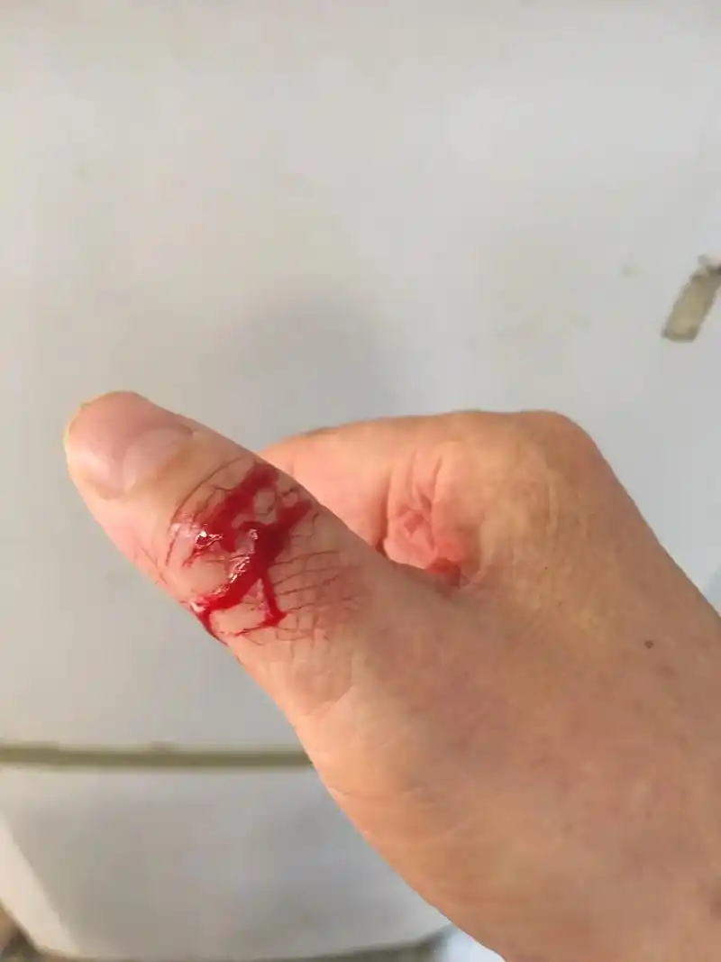 噢嚯,菜还没切好,手被割伤了.我恨不得一巴掌呼死自已9898 - 抖音