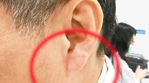 肝不好,脸上有3个"不对劲",要是你1个都没,偷着乐呵吧!