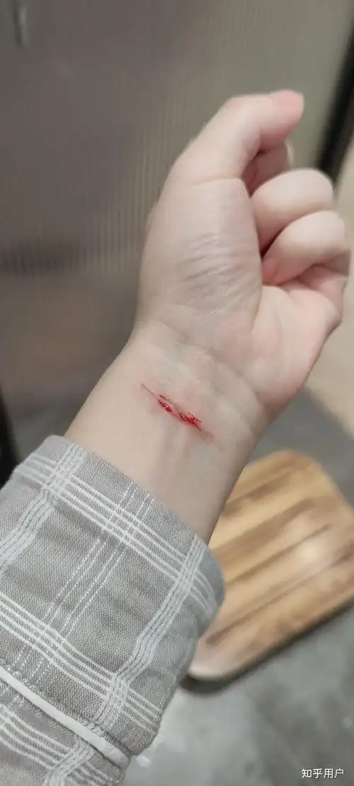 割腕自残的心理障碍患者一般有怎样的心理动机实际实践时有什么感受和