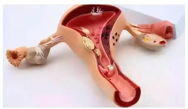 女性结扎之后,排出的卵子去哪里了呢?看完或涨知识了_网易订阅