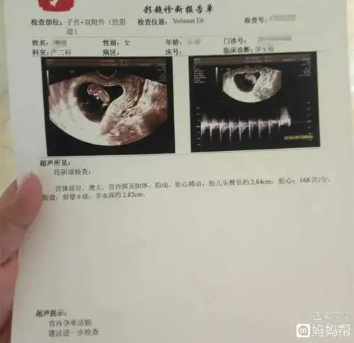 怀孕两周便知儿女性别?