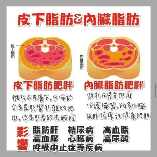 肥胖有分两种,分别内脏脂肪和皮下脂肪,比较危险的是内脏脂肪肥胖.