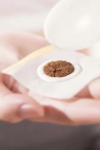 疗法——黔南州中医医院国医堂中医儿科门诊开展小儿中药穴位贴敷治疗