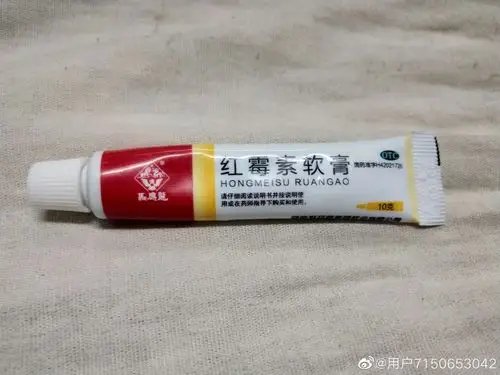 结节囊肿型痤疮应该用什么外用药膏