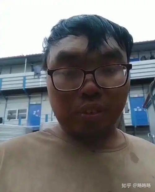 我想知道什么样算丑 ? - 知乎