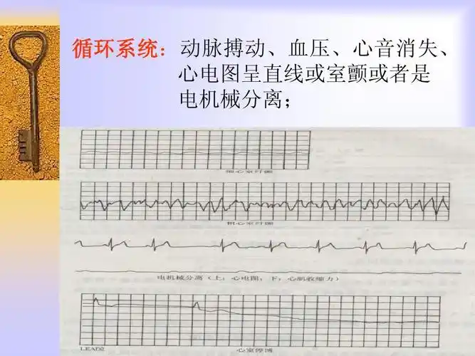 搏动,血压,心音消失, 循环系统 心电图呈直线或室颤或者是 电机械分离