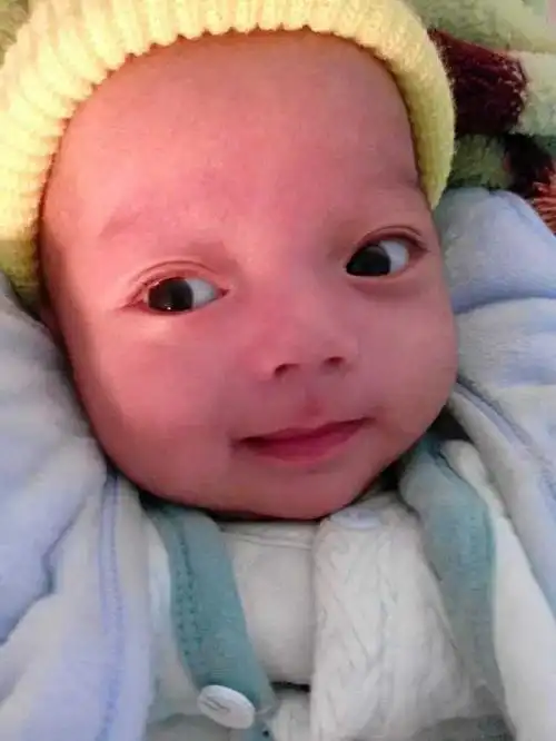 29周早产宝宝又来冒泡咯,以前说俺宝宝是斗鸡眼,唐氏儿…的麻麻们你