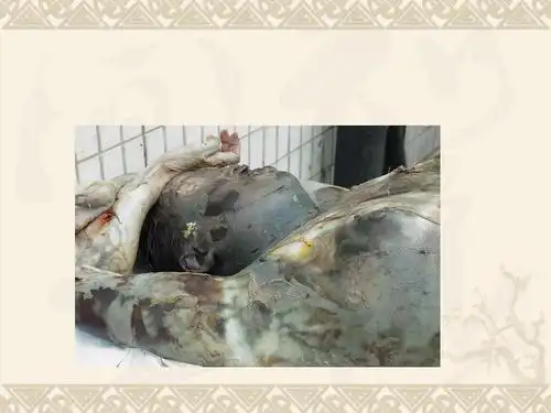 尸体现象ppt 第58页 (共90页,当前第58页) 你可能喜欢 法医病理学