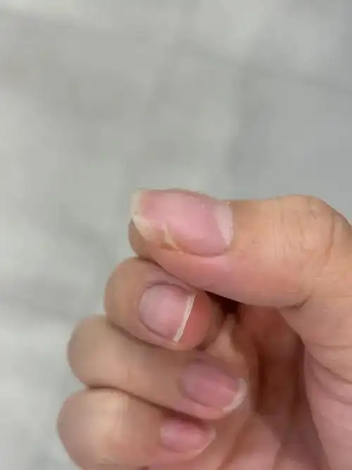 指甲断了怎么办