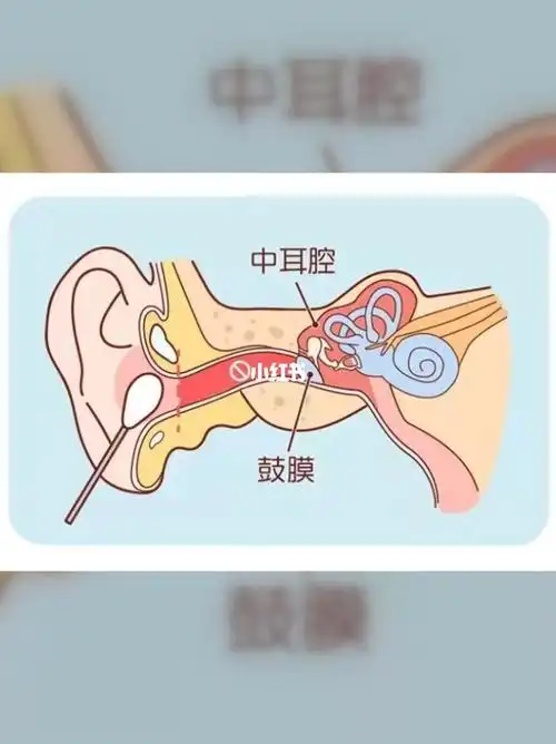 但如果不干净的液体长期积聚在耳中,容易引发炎症感染,造成中耳炎