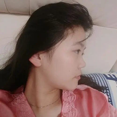 我真的搞不懂为什么侧脸那么丑 超级超级扁平 更夸张_圈子-新氧美容