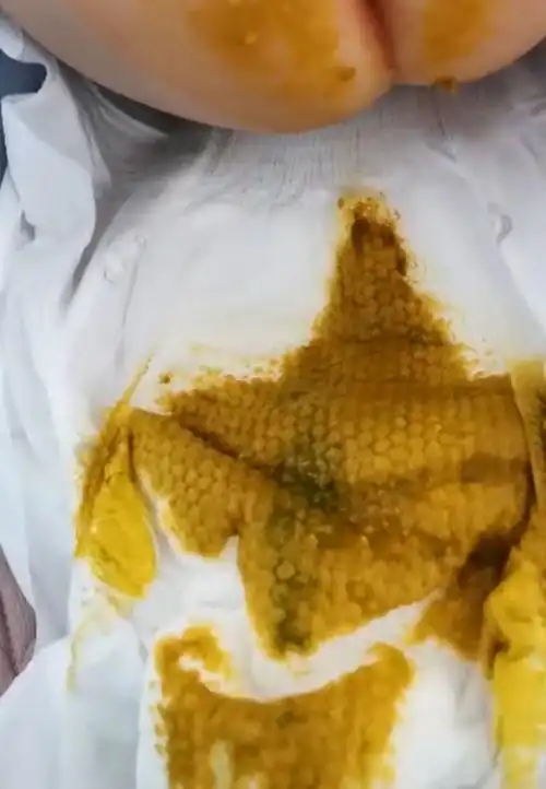 能被隔断在松紧内部再比如演示拉得很多的时候如果事先没有垫住隔尿垫