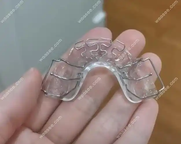 矫正牙套多少钱价格表2022超全公布