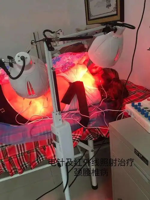 电针及红外线照射治疗颈腰椎病