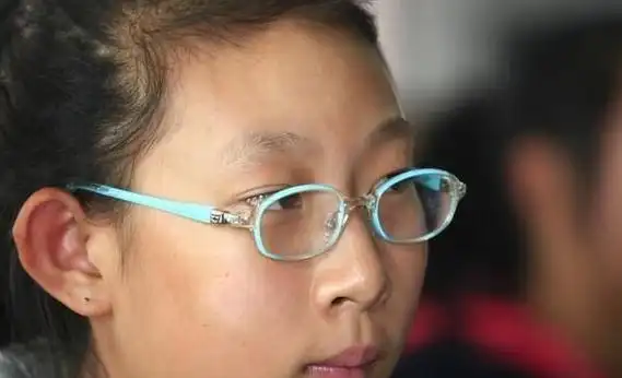 眼镜戴久了眼睛凹陷