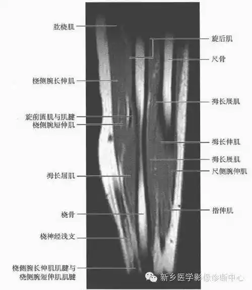 前臂精细mr断层解剖标注