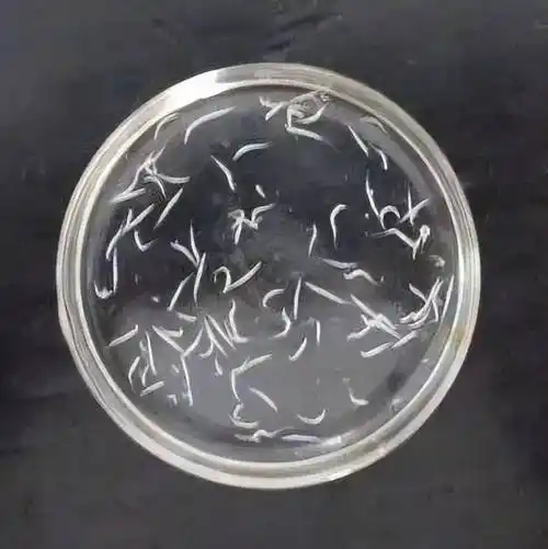 全家都会感染_蛲虫_孩子_虫卵