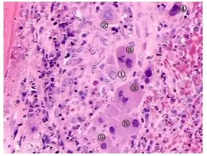 正常骨髓活检组织切片的细胞形态