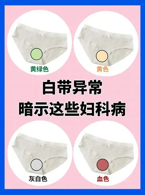 白带异常是身体的求救信号女性朋友赶紧自查