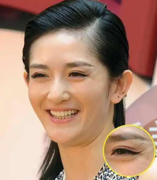 不管男人还是女人这个地方出现笑纹你知道代表什么吗