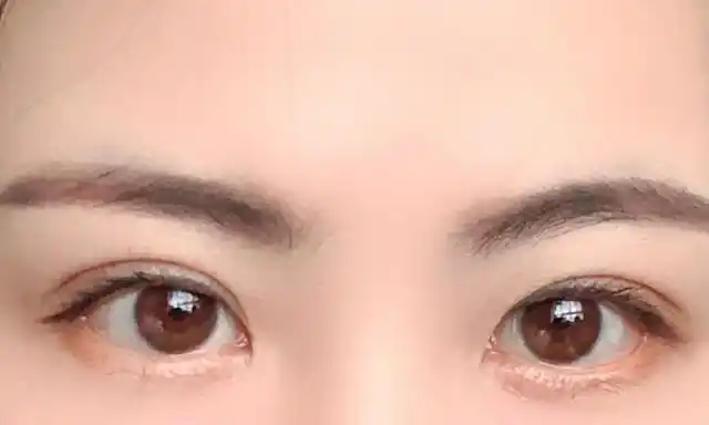 4种受欢迎的双眼皮形状,平行型公认最好看,平扇形颜值高,你呢