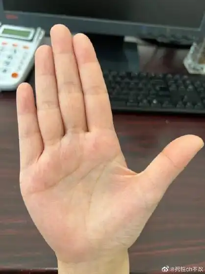 96从手相学角度看,你的手掌形状堪称完美,掌丘饱满,预示着你在事业