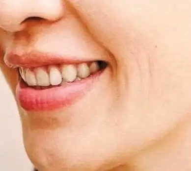 5,女子狼嘴,能旺夫,但是要切记女子的嘴千万不能是吹火口,吹火口阐明