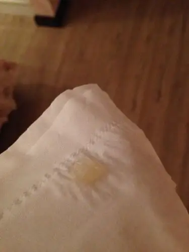 孕早期,白带跟果冻一样?