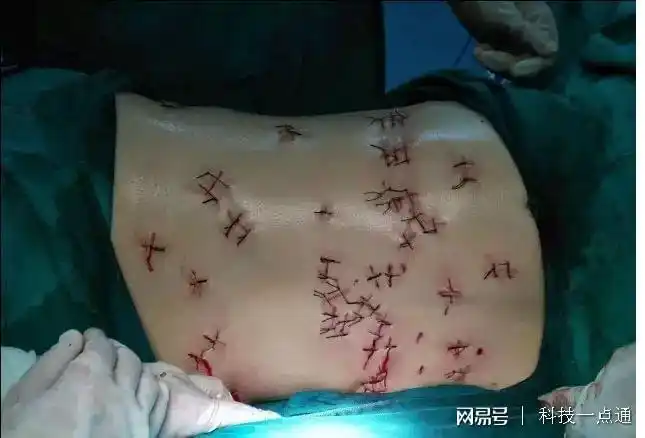 女子因拒绝已婚男表白 遭报复被刺66刀