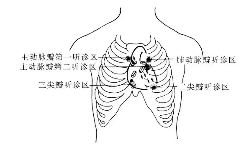图4-6-3 心脏瓣膜听诊区示意图内容包括心率,节律,心音,额外心音,杂音