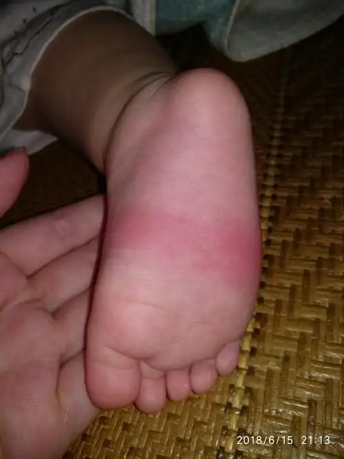 诚信品牌!出生宝宝人鱼之泪脚饰"千山万水"-第1张图片-西安论坛资讯