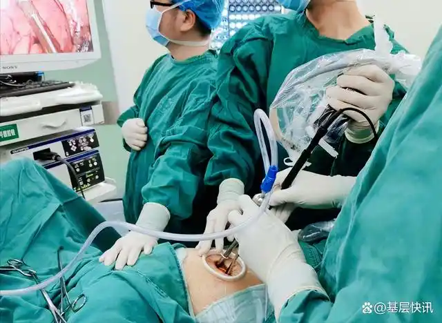 盐亭县人民医院胸外科成功开展首例单孔胸腔镜下肺叶切除术