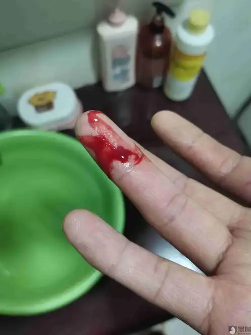 拼多多购买的商品划破手指