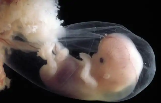 孕期检查,胚芽1.7厘米,是怀孕多长时间?关于胚胎发育,看看吧