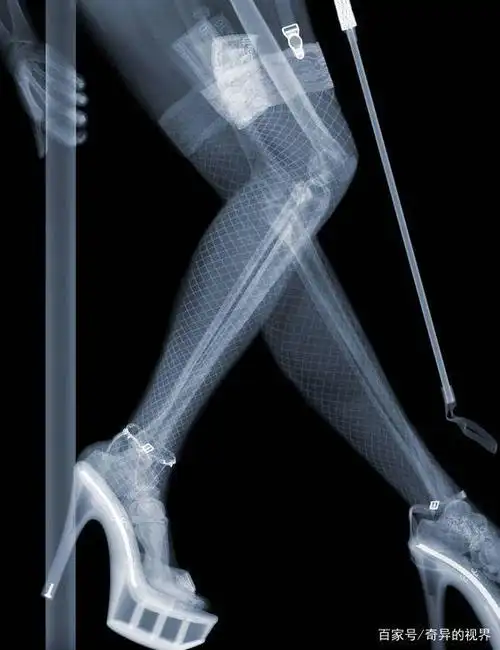 x射线摄影图集-用x光拍摄的照片