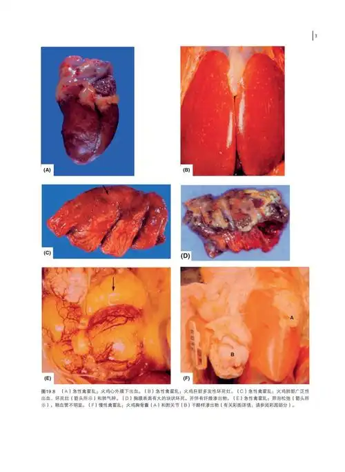 第28章 原虫感染1195