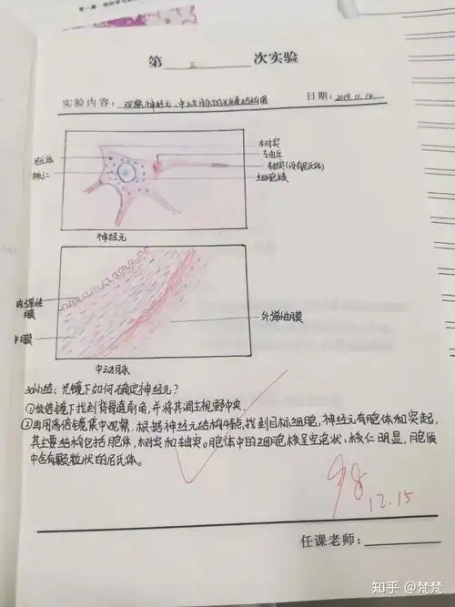 神经元中动脉光镜结构图